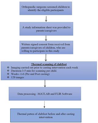 Infrared Thermal Imaging for Evaluation of Clubfoot After the Ponseti Casting Method—An Exploratory Study